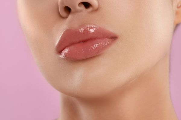 Foto de uma boca com o Preenchimento Labial feito